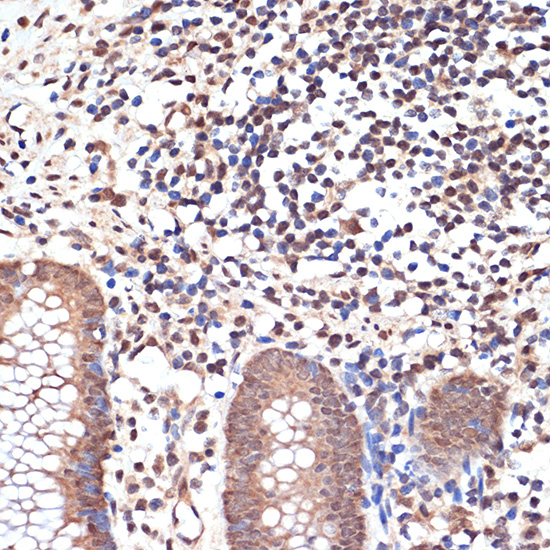 KAT8/MYST1/MOF Monoclonal Antibody [6U5Z6]
