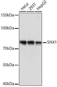 SNX1 Monoclonal Antibody [8G8Z2]