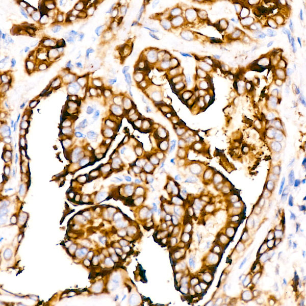 Thyroglobulin Monoclonal Antibody [3I10H1]