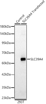 SLC39A4 Polyclonal Antibody