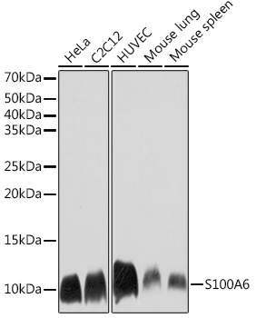 S100A6 Monoclonal Antibody [0J1Q5]