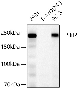 Slit2 Monoclonal Antibody [1T5A3]