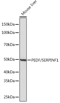 PEDF/SERPINF1 Monoclonal Antibody [4H0C5]