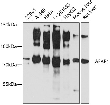 AFAP1 Polyclonal Antibody&nbsp;<img src="images/icon_newarrival.gif" alt="new" border="0">