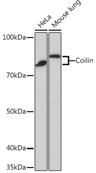 Coilin Monoclonal Antibody [7Z4K1]