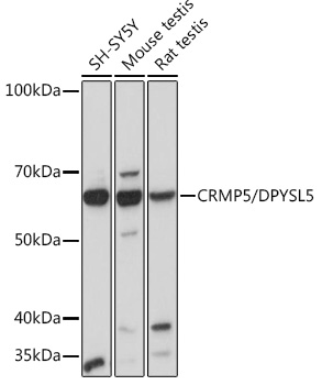 CRMP5/DPYSL5 Monoclonal Antibody [5L4S8]
