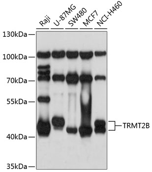 TRMT2B Polyclonal Antibody