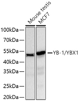 YB-1/YBX1 Monoclonal Antibody [9J7M4]