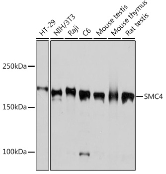 SMC4 Monoclonal Antibody [9Z8S3]