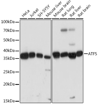 ATF5 Monoclonal Antibody [9Z3M0]