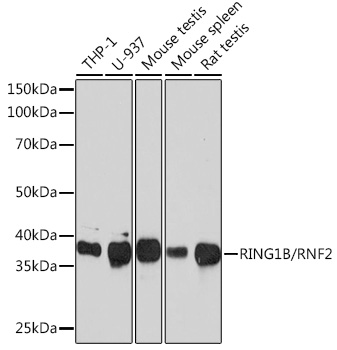 RING1B/RNF2 Monoclonal Antibody [9Q2W2]