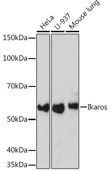 Ikaros Monoclonal Antibody [4S10I3]