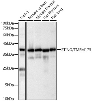 STING/TMEM173 Polyclonal Antibody