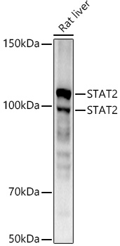 STAT2 Monoclonal Antibody [4A5P8]&nbsp;<img src="images/icon_newarrival.gif" alt="new" border="0">
