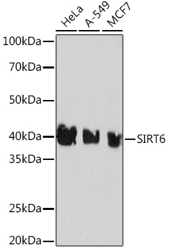SIRT6 Monoclonal Antibody&nbsp;<img src="images/icon_newarrival.gif" alt="new" border="0">