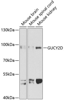 GUCY2D Polyclonal Antibody