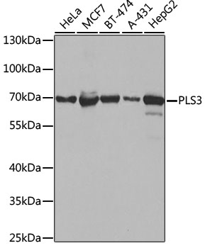 PLS3 Polyclonal Antibody