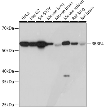 RBBP4 Monoclonal Antibody [0D1X1]