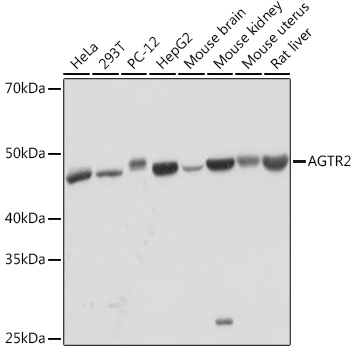 AGTR2 Monoclonal Antibody [0V7Y3]&nbsp;<img src="images/icon_newarrival.gif" alt="new" border="0">