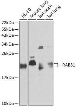 RAB31 Polyclonal Antibody