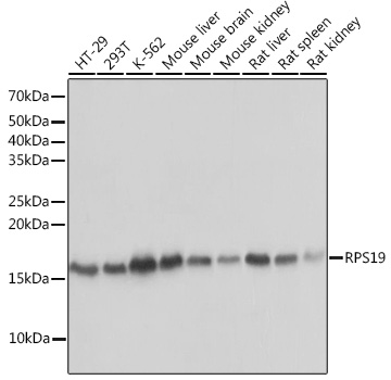 RPS19 Monoclonal Antibody [4V3S7]