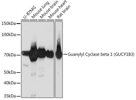 Guanylyl Cyclase beta 1 (GUCY1B3) Monoclonal Antibody [5O8D9]