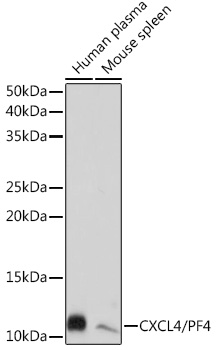 CXCL4/PF4 Monoclonal Antibody [6Q10H2]