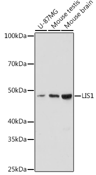 LIS1 Monoclonal Antibody [9O6X3]