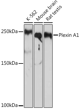 Plexin A1 Monoclonal Antibody [2A5Z6]