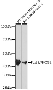 Fbx32/FBXO32 Monoclonal Antibody [1F10Z5]
