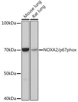 NOXA2/p67phox Monoclonal Antibody [7J7N3]