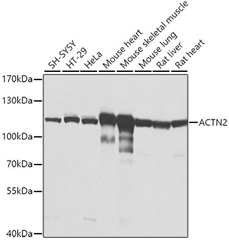 ACTN2 Polyclonal Antibody&nbsp;<img src="images/icon_newarrival.gif" alt="new" border="0">