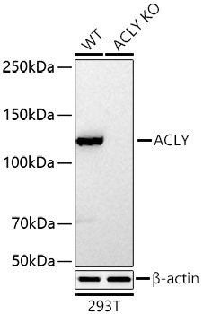 ACLY Monoclonal Antibody [8A0V0]&nbsp;<img src="images/icon_newarrival.gif" alt="new" border="0">