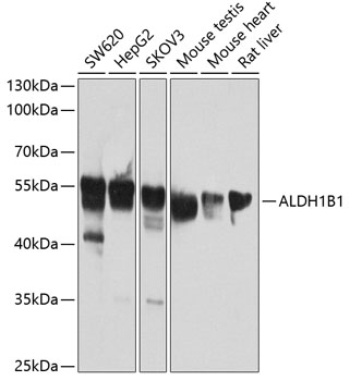 ALDH1B1 Polyclonal Antibody