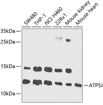 ATP5J Polyclonal Antibody