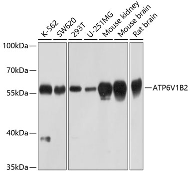 ATP6V1B2 Polyclonal Antibody