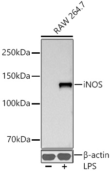 iNOS Monoclonal Antibody [3L0U6]