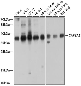 CAPZA1 Polyclonal Antibody