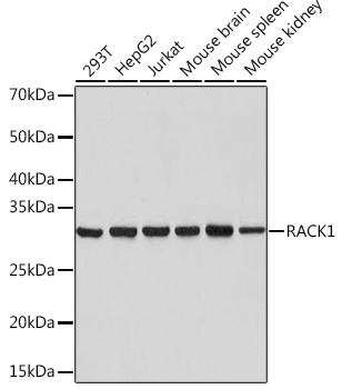 RACK1 Monoclonal Antibody [7B6J4]