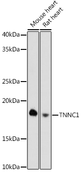 TNNC1 Monoclonal Antibody [8Z4V9]
