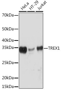 TREX1 Monoclonal Antibody [7Q0G6]
