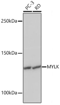 MYLK Monoclonal Antibody [1J2U2]