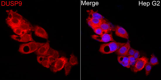 DUSP9 Polyclonal Antibody