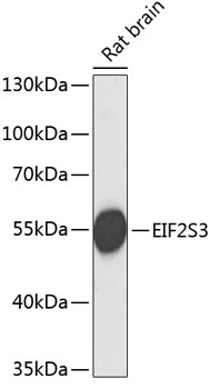 EIF2S3 Polyclonal Antibody