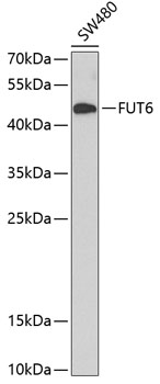 FUT6 Polyclonal Antibody