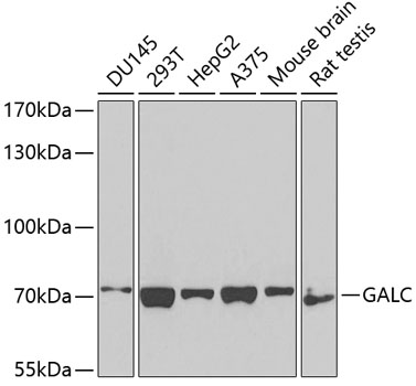 GALC Polyclonal Antibody
