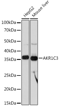 AKR1C3 Monoclonal Antibody [7T10F5]