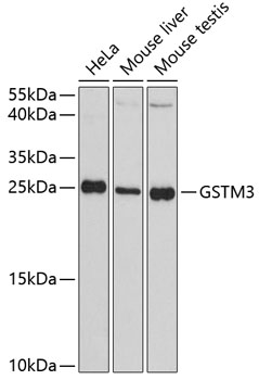 GSTM3 Polyclonal Antibody