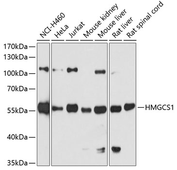 HMGCS1 Polyclonal Antibody