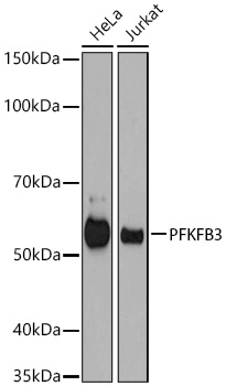 PFKFB3 Monoclonal Antibody [7X10D9]